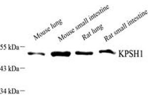 Western blot analysis of PSKH1 (ABIN7075291),at dilution of 1: 1500,Lane 1: Mouse lung tissue lysate,Lane 2: Mouse small intestine tissue lysate,Lane 3: Rat lung tissue lysate,Lane 4: Rat small intestine tissue lysate (PSKH1 antibody)