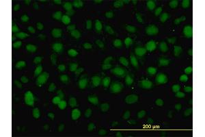 Immunofluorescence of monoclonal antibody to RAD54B on HeLa cell. (RAD54B antibody  (AA 801-910))