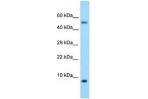 Image no. 1 for anti-S100 Calcium Binding Protein A10 (S100A10) (C-Term) antibody (ABIN6748414) (S100A10 antibody  (C-Term))
