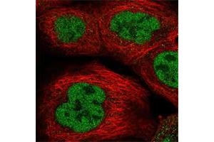 Immunofluorescent staining of human cell line A-431 shows positivity in nucleus but not nucleoli.
