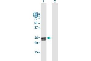 Western Blot analysis of FLJ20397 expression in transfected 293T cell line by FLJ20397 MaxPab polyclonal antibody. (HEATR2 antibody  (AA 1-223))