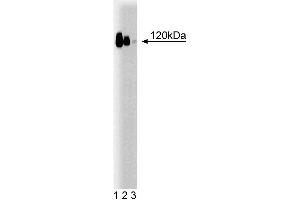 Western blot analysis of E-Cadherin on A431 cell lysate. (E-cadherin antibody  (AA 735-883))
