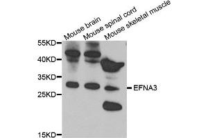 Western blot analysis of extract of various cells, using EFNA3 antibody. (Ephrin A3 antibody)