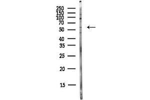 anti-Solute Carrier Family 2 (Facilitated Glucose Transporter), Member 2 (SLC2A2) (N-Term) antibody