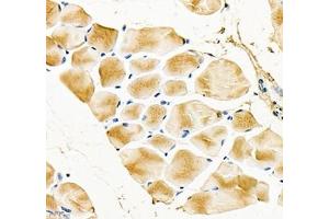 Immunohistochemistry of paraffin embedded mouse Skeletal muscle using Igfn1 (ABIN7074278) at dilution of 1:700 (400x lens) (IGFN1 antibody)