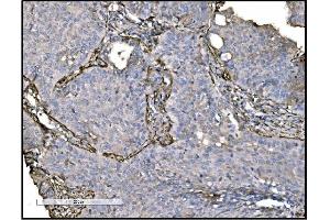 IHC analysis of TAGLN/Transgelin using anti-TAGLN/Transgelin antibody (ABIN7600099). (Transgelin antibody  (AA 15-170))