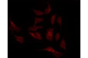 ABIN6275869 staining K562 by IF/ICC. (SLC44A1 antibody  (Internal Region))