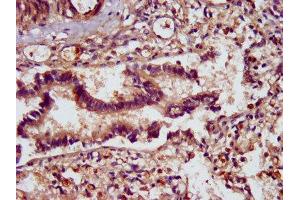 IHC image of ABIN7169639 diluted at 1:400 and staining in paraffin-embedded human lung tissue performed on a Leica BondTM system. (SCUBE2 antibody  (AA 534-703))