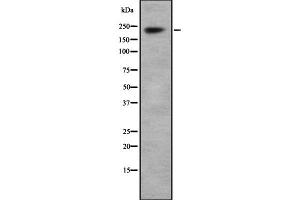Western blot analysis Na+ CP type I alpha using HepG2 whole cell lysates (SCN1A antibody  (Internal Region))