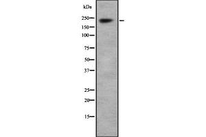 Western blot analysis Na+ CP type I alpha using HepG2 whole cell lysates