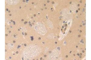 DAB staining on IHC-P; Samples: Rat Brain Tissue (CENPE antibody  (AA 2222-2361))