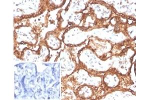 Formalin-fixed, paraffin-embedded human placenta stained with HCG-beta Rabbit Recombinant Monoclonal Antibody (HCGa/2728R). (Recombinant CGA antibody  (AA 1-100))