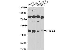 Western blot analysis of extracts of various cell lines, using CHRNB2 Antibody (ABIN6003540) at 1/1000 dilution. (CHRNB2 antibody)