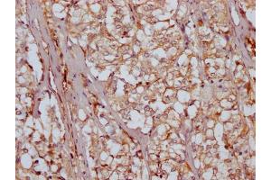 IHC image of ABIN7164325 diluted at 1:200 and staining in paraffin-embedded human adrenal gland tissue performed on a Leica BondTM system. (RARS2 antibody  (AA 230-578))
