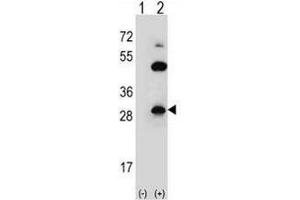 Western blot analysis of CLDN2 (arrow) using rabbit polyclonal CLDN2 Antibody (pTyr224) . (Claudin 2 antibody  (C-Term))