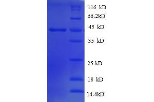 Malic Enzyme 2, NADP+ Dependent, Mitochondrial (AA 300-555) protein (His-SUMO Tag)