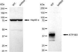 Western blotting analysis using ATP1B3 antibody (ABIN7797700).