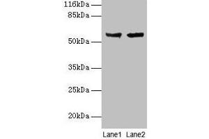 Western blot All lanes: CYP17A1 antibody at 2 μg/mL Lane 1: Hela whole cell lysate Lane 2: A549 whole cell lysate Secondary Goat polyclonal to rabbit IgG at 1/10000 dilution Predicted band size: 58 kDa Observed band size: 58 kDa (CYP17A1 antibody  (AA 1-508))