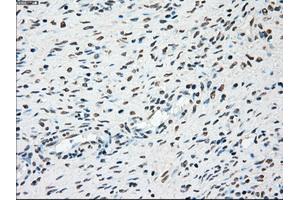 Immunohistochemical staining of paraffin-embedded colon tissue using anti-PLK1mouse monoclonal antibody. (PLK1 antibody)