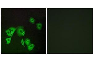 Immunofluorescence analysis of A549 cells, using TTF2 antibody. (TTF2 antibody  (Internal Region))