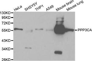 Western blot analysis of extracts of various cell lines, using PPP3CA antibody (ABIN5970422) at 1/1000 dilution. (PPP3CA antibody)