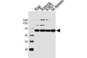 Western blot analysis of lysates from Raji, Ramos, K562 cell line and mouse spleen tissue lysate(from left to right), using BTK Antibody (Center) (ABIN6243554 and ABIN6577451). (BTK antibody  (AA 396-430))