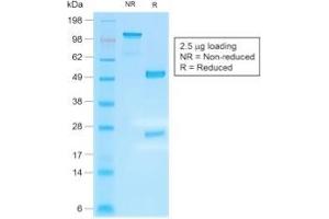 SDS-PAGE Analysis Purified IgG4 Recombinant Rabbit Monoclonal Antibody (IGHG4/2042R).