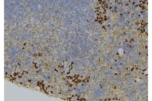 ABIN6273660 at 1/100 staining Human lymph node tissue by IHC-P. (IL-6 Receptor antibody  (N-Term))