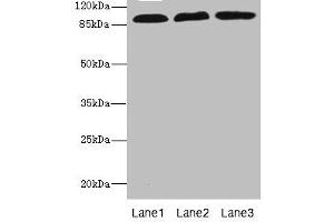 Western blot All lanes: CD97 antibody at 3. (CD97 antibody  (AA 240-435))