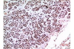 Immunohistochemistry (IHC) analysis of paraffin-embedded Human Pancreas, antibody was diluted at 1:100. (KLF13 antibody)