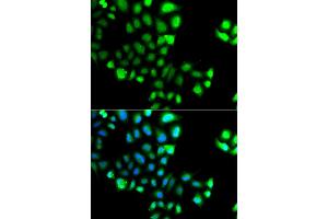 Immunofluorescence analysis of A549 cell using SUMO4 antibody. (SUMO4 antibody)