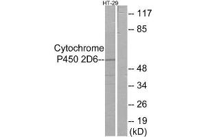 Western Blotting (WB) image for anti-Cytochrome P450, Family 2, Subfamily D, Polypeptide 6 (CYP2D6) (Internal Region) antibody (ABIN1850357) (CYP2D6 antibody  (Internal Region))