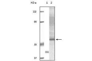 Western Blot showing Akt3 antibody used against truncated Akt3 recombinant protein (1) and human ovary carcinoma tissue lysate (2). (AKT3 antibody)