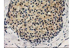 Image no. 2 for anti-V-Set and Immunoglobulin Domain Containing 2 (VSIG2) antibody (ABIN1501737) (VSIG2 antibody)