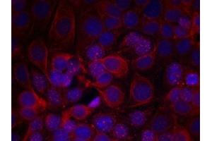 Immunofluorescence staining of methanol-fixed MCF cells using HER2(Phospho-Tyr1221/Tyr1222) Antibody. (ErbB2/Her2 antibody  (pTyr1221, pTyr1222))