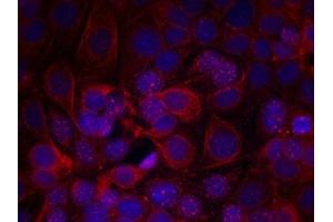 Immunofluorescence staining of methanol-fixed MCF cells using HER2(Phospho-Tyr1221/Tyr1222) Antibody. (ErbB2/Her2 antibody  (pTyr1221, pTyr1222))