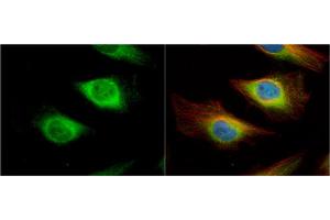 ICC/IF Image Creatine kinase (brain) antibody [N1C1] detects Creatine kinase (brain) protein at cytoplasm and nucleus by immunofluorescent analysis. (CKB antibody)