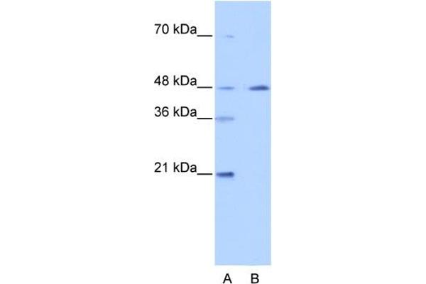NR2F2 anticorps  (N-Term)