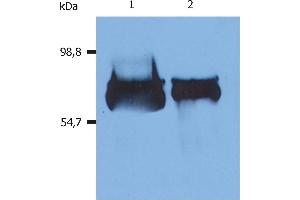 Western Blotting analysis (reducing conditions) of human serum albumin using anti-human Albumin (AL-01). (Albumin antibody  (Biotin))