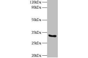 Western blot All lanes: CYB5R3 antibody at 2 μg/mL + 293T whole cell lysate Secondary Goat polyclonal to rabbit IgG at 1/10000 dilution Predicted band size: 35, 32, 39 kDa Observed band size: 32 kDa (CYB5R3 antibody  (AA 1-301))