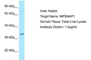 Western Blotting (WB) image for anti-4-Nitrophenylphosphatase Domain and Non-Neuronal SNAP25-Like Protein Homolog 1 (NIPSNAP1) (C-Term) antibody (ABIN2790155) (NIPSNAP1 antibody  (C-Term))