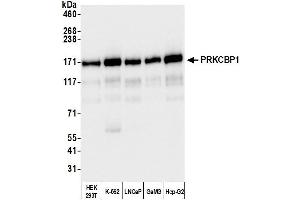 Western Blotting (WB) image for anti-Zinc Finger, MYND-Type Containing 8 (ZMYND8) (AA 775-825) antibody (ABIN7451981)