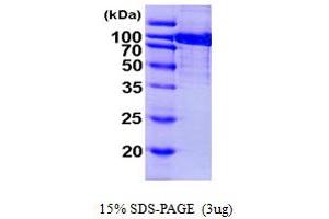 Aconitase 1 Protein (ACO1) (AA 1-889) (His tag)