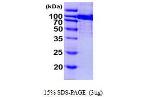 SDS-PAGE (SDS) image for Aconitase 1 (ACO1) (AA 1-889) protein (His tag) (ABIN667323)