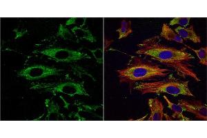ICC/IF Image UAP1 antibody [N1C3] detects UAP1 protein at cytoplasm by immunofluorescent analysis.