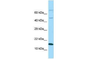 Western Blotting (WB) image for anti-GABA(A) Receptor-Associated Protein Like 1 (GABARAPL1) (Middle Region) antibody (ABIN2774240) (GABARAPL1 antibody  (Middle Region))