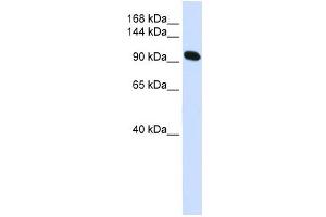 Alpha Actinin 2 antibody used at 1 ug/ml to detect target protein. (ACTN2 antibody  (N-Term))