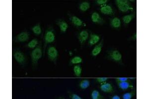 Immunofluorescence analysis of HeLa cells using CPS1 Polyclonal Antibody at dilution of 1:100 (40x lens). (CPS1 antibody)