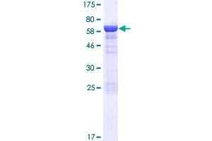 Ankyrin Repeat, SAM and Basic Leucine Zipper Domain Containing 1 (ASZ1) (AA 1-393) protein (GST tag)