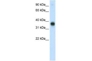 E2F3 antibody used at 0. (E2F3 antibody  (C-Term))